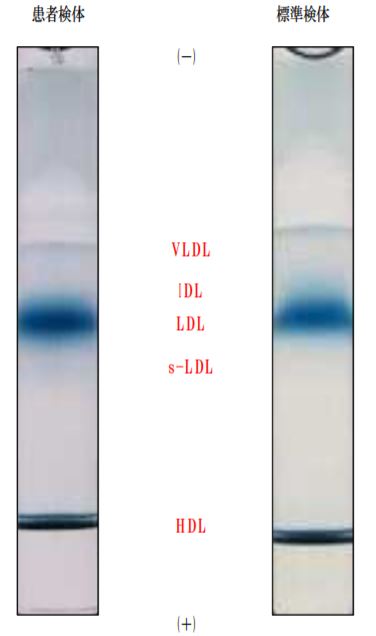 私の小さな危険なLDLはどれくらいあるか？