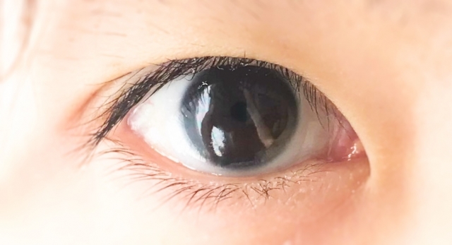 ナイアシンによる眼毒性　その1