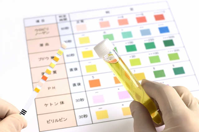 尿糖が陽性というのは実際どれほどの糖が尿に出ているのか？