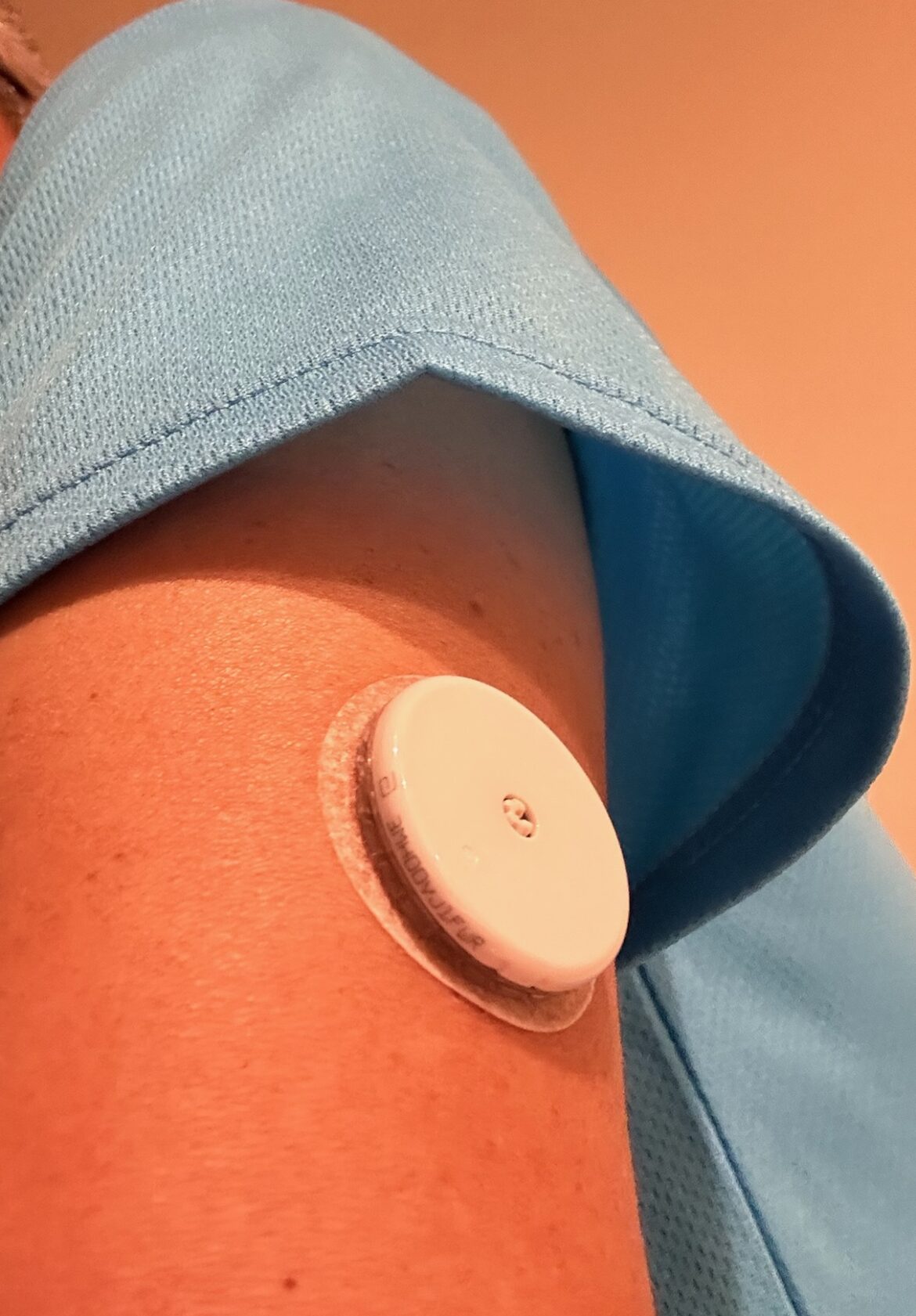 糖尿病患者以外の人によるフリースタイルリブレ（持続血糖測定器）の使用