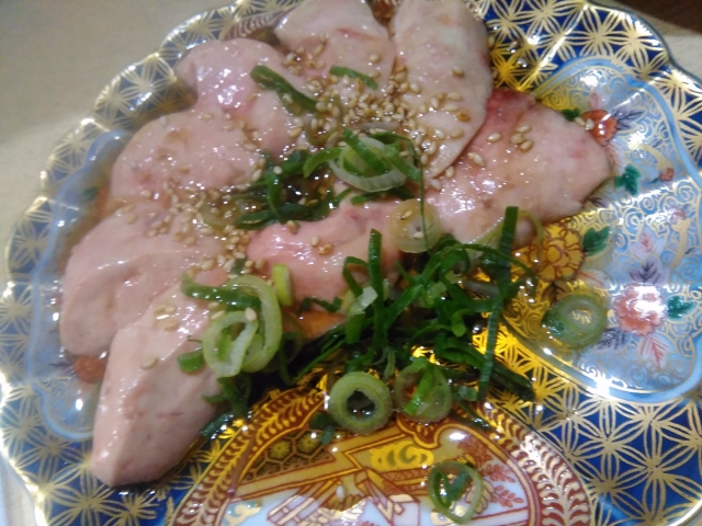 尿酸値はなんでそんなに高くなるの？　その2　尿酸排泄低下